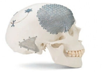 Cranio1_1