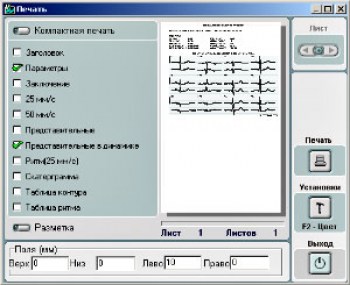 ecg-print