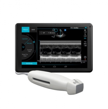 sonosite-iviz-2-398x400