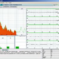 hrv-